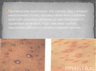 Проникнувши через шкіру або слизові, вірус починає циркулювати у крові; при вкор