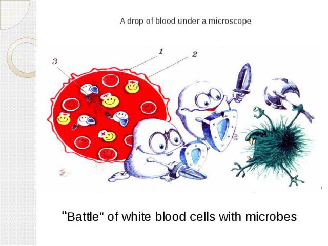 A drop of blood under a microscope “Battle" of white blood cells with microbes