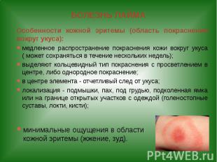 БОЛЕЗНЬ ЛАЙМА Особенности кожной эритемы (область покраснения вокруг укуса): мед