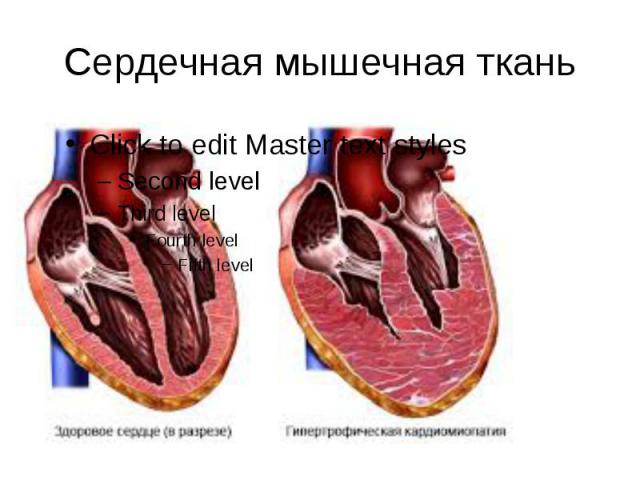 Сердечная мышечная ткань