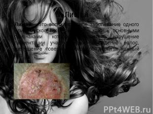 Лишай Лишай – это воспалительное заболевание одного или нескольких участков кожи