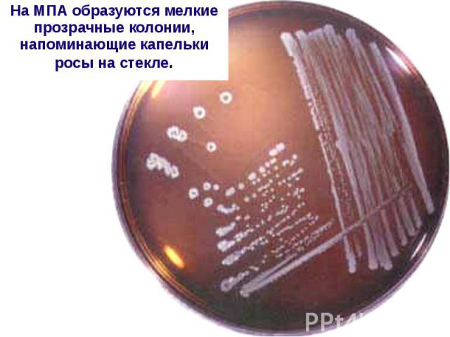 На МПА образуются мелкие прозрачные колонии, напоминающие капельки росы на стекле. На МПА образуются мелкие прозрачные колонии, напоминающие капельки росы на стекле.