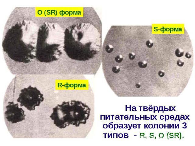На твёрдых питательных средах образует колонии 3 типов - R, S, O (SR). На твёрдых питательных средах образует колонии 3 типов - R, S, O (SR).