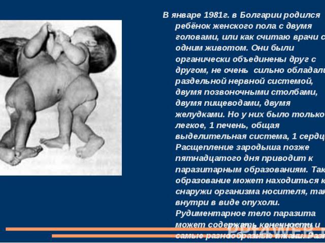 В январе 1981г. в Болгарии родился ребёнок женского пола с двумя головами, или как считаю врачи с одним животом. Они были органически объединены друг с другом, не очень сильно обладали раздельной нервной системой, двумя позвоночными столбами, двумя …