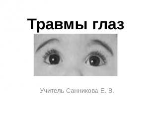 Травмы глаз Учитель Санникова Е. В.