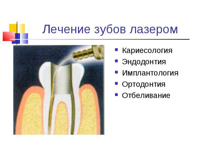 Кариесология Кариесология Эндодонтия Имплантология Ортодонтия Отбеливание