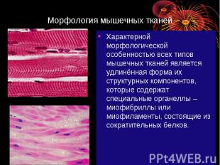 Морфология мышечных тканей Характерной морфологической особенностью всех типов м