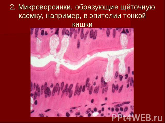 2. Микроворсинки, образующие щёточную каёмку, например, в эпителии тонкой кишки