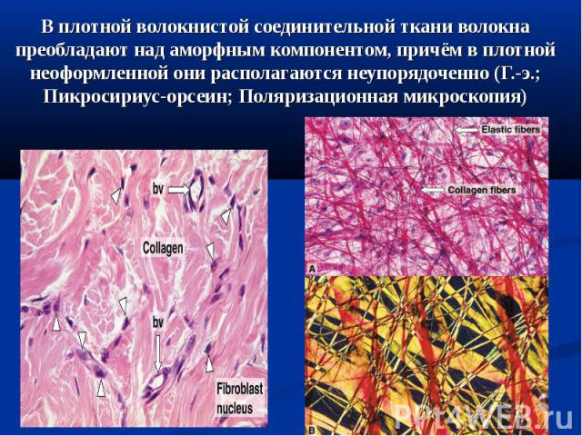 В плотной волокнистой соединительной ткани волокна преобладают над аморфным компонентом, причём в плотной неоформленной они располагаются неупорядоченно (Г.-э.; Пикросириус-орсеин; Поляризационная микроскопия)