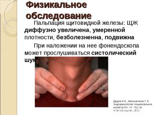 Пальпация щитовидной железы: ЩЖ диффузно увеличена, умеренной плотности, безболе