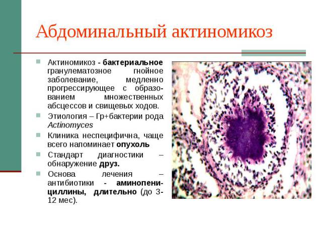 Абдоминальный актиномикоз Актиномикоз - бактериальное гранулематозное гнойное заболевание, медленно прогрессирующее с образо-ванием множественных абсцессов и свищевых ходов. Этиология – Гр+бактерии рода Actinomyces Клиника неспецифична, чаще всего н…