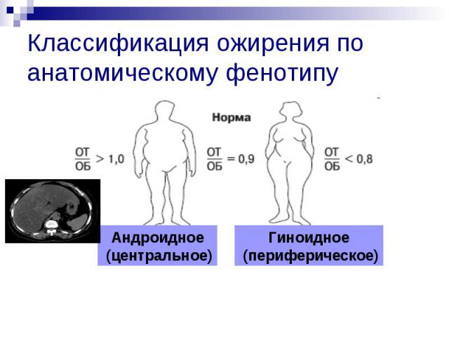 Классификация ожирения по анатомическому фенотипу