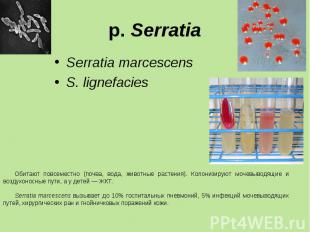 Serratia marcescens Serratia marcescens S. lignefacies