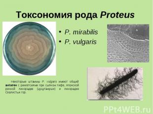 P. mirabilis P. mirabilis Р. vulgaris