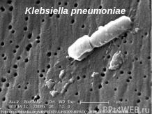 2.3 Klebsiella pneumoniae