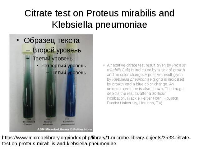 Citrate test on Proteus mirabilis and Klebsiella pneumoniae A negative citrate test result given by Proteus mirabilis (left) is indicated by a lack of growth and no color change. A positive result given by Klebsiella pneumoniae (right) is indicated …