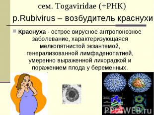 Краснуха - острое вирусное антропонозное заболевание, характеризующаяся мелкопят