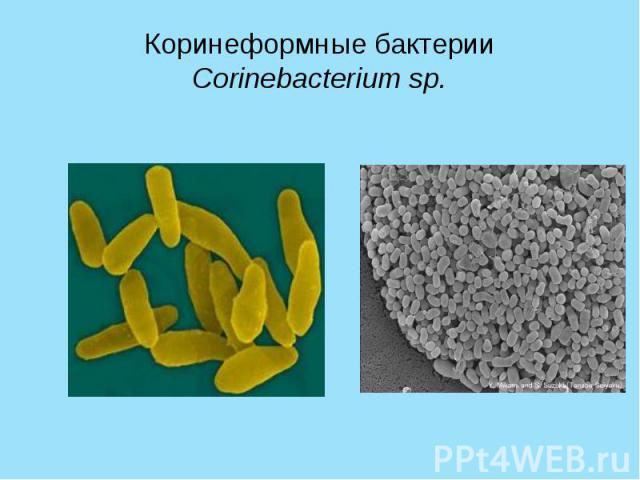 Коринеформные бактерии Corinebacterium sp.