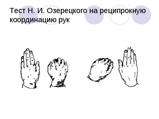 Тест Н. И. Озерецкого на реципрокную координацию рук
