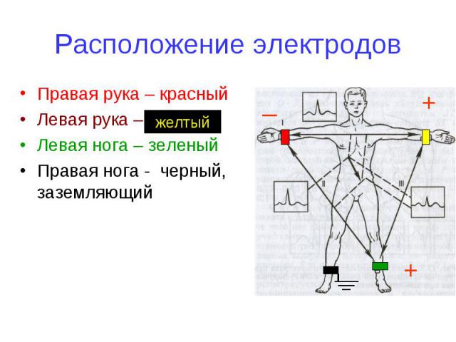 Расположение электродов Правая рука – красный Левая рука – Левая нога – зеленый Правая нога - черный, заземляющий