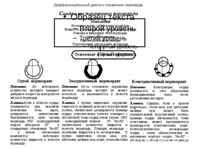 Дифференциальный диагноз поражения перикарда