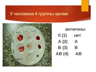 антигены антигены 0 (1) нет А (2) А В (3) В АВ (4) АВ