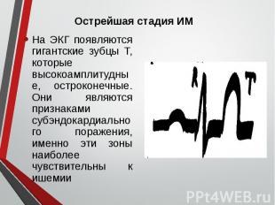 На ЭКГ появляются гигантские зубцы Т, которые высокоамплитудные, остроконечные.