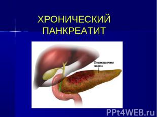 Хирургическое лечение хронического панкреатита презентация