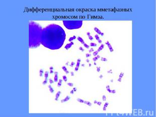 Дифференциальная окраска мметафазных хромосом по Гимза.