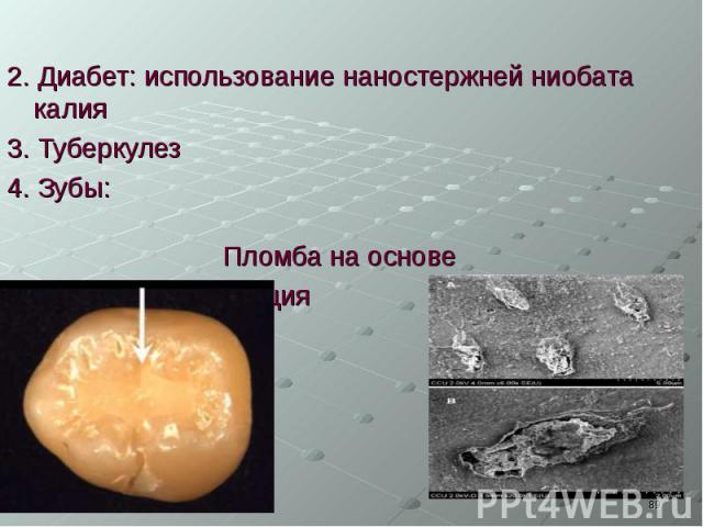 2. Диабет: использование наностержней ниобата калия 3. Туберкулез 4. Зубы: Пломба на основе нанокомпозита кальция золотые наночастицы
