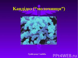 Кандідоз (“молочниця”)