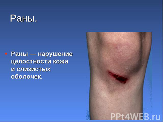 Раны — нарушение целостности кожи и слизистых оболочек. Раны — нарушение целостности кожи и слизистых оболочек.