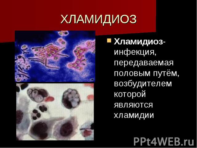 ХЛАМИДИОЗ Хламидиоз- инфекция, передаваемая половым путём, возбудителем которой являются хламидии
