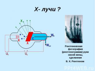 Рентгеновская фотография (рентгенограмма) руки своей жены, сделанная В.&nbsp;К.&