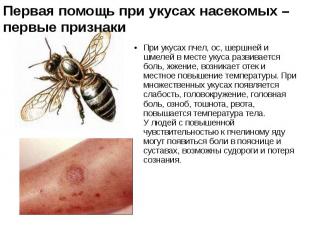 При укусах пчел, ос, шершней и шмелей в месте укуса развивается боль, жжение, во