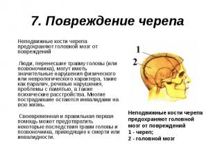 Неподвижные кости черепа предохраняют головной мозг от повреждений Неподвижные к