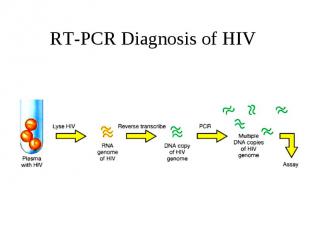 RT-PCR Diagnosis of HIV