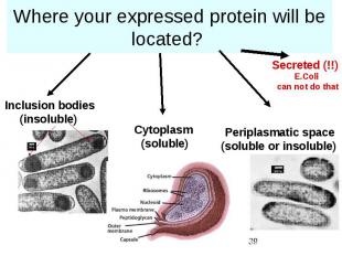 Where your expressed protein will be located?