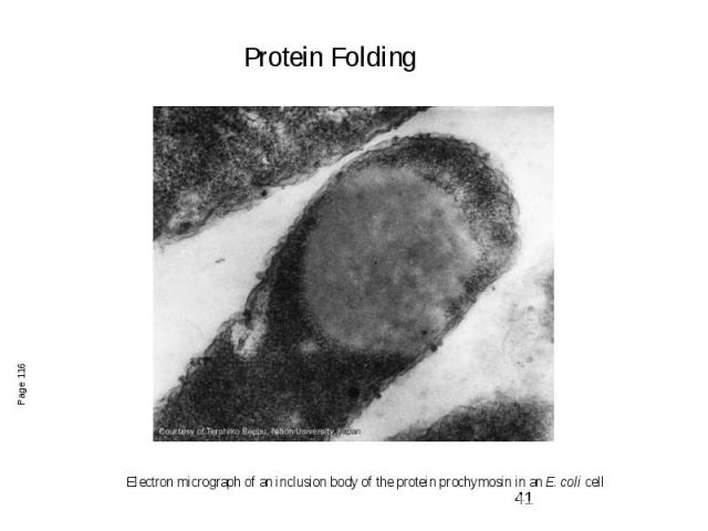 Electron micrograph of an inclusion body of the protein prochymosin in an E. coli cell