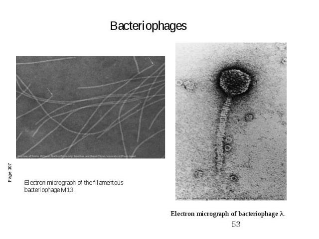 Electron micrograph of bacteriophage λ.