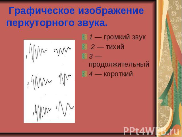 Графическое изображение перкуторного звука. 1 — громкий звук 2 — тихий 3 — продолжительный 4 — короткий