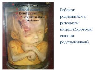 Ребенок родившийся в результате инцеста(кровосмешения родственников). Ребенок ро