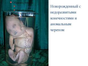 Новорожденный с недоразвитыми конечностями и аномальным черепом Новорожденный с