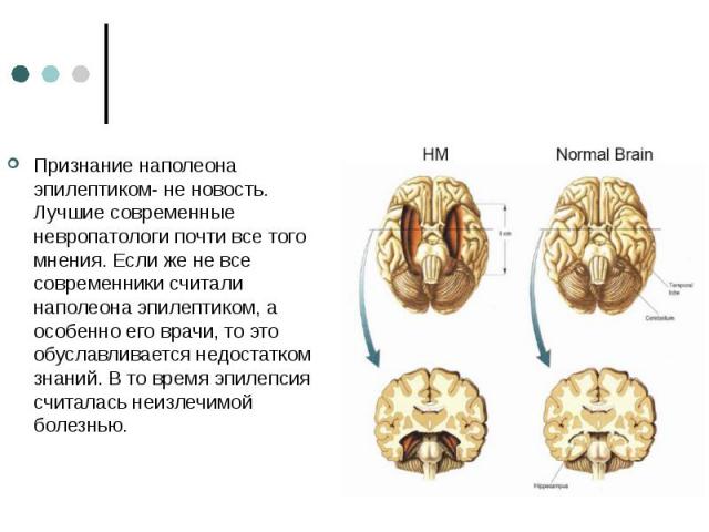 Признание наполеона эпилептиком- не новость. Лучшие современные невропатологи почти все того мнения. Если же не все современники считали наполеона эпилептиком, а особенно его врачи, то это обуславливается недостатком знаний. В то время эпилепсия счи…