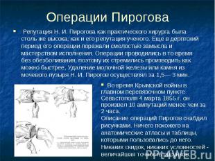 Операции Пирогова Репутация Н. И. Пирогова как практического хирурга была столь