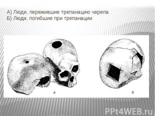 А) Люди, пережившие трепанацию черепа Б) Люди, погибшие при трепанации