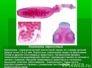 Эхинококк зернистый Эхинококк зернистый Эхинококк - паразитический ленточный чер