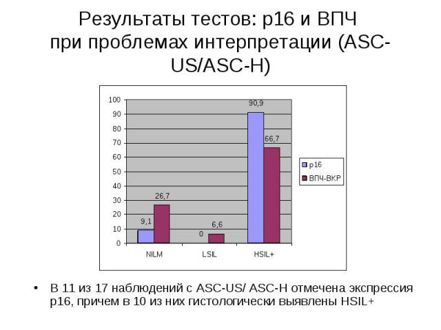 В 11 из 17 наблюдений с ASC-US/ ASC-H отмечена экспрессия р16, причем в 10 из них гистологически выявлены HSIL+ В 11 из 17 наблюдений с ASC-US/ ASC-H отмечена экспрессия р16, причем в 10 из них гистологически выявлены HSIL+