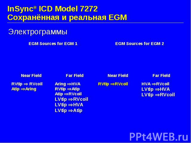 InSync® ICD Model 7272 Сохранённая и реальная EGM Электрограммы