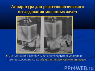 Аппаратура для рентгенологического исследования молочных желез До конца 80-х год